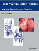Posterolateral Knee Injuries  Anatomy, Evaluation, and Treatment