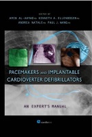 Pacemakers and Implantable Cardioverter Defibrillators: An Expert’s Manual